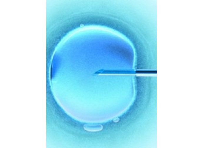 Fecondazione in vitro